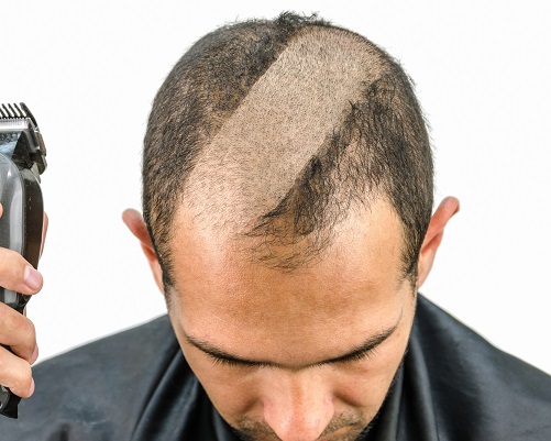 haircut